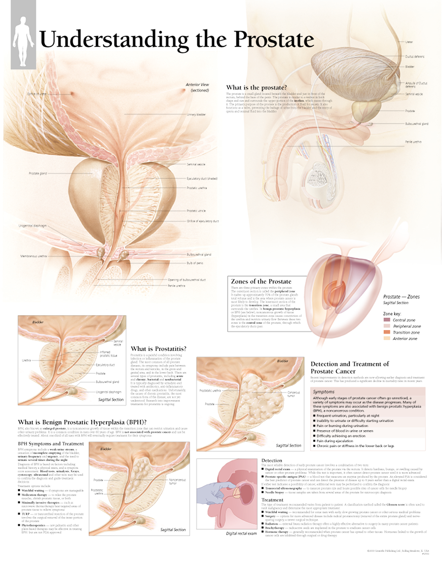 Understanding the Prostate Chart